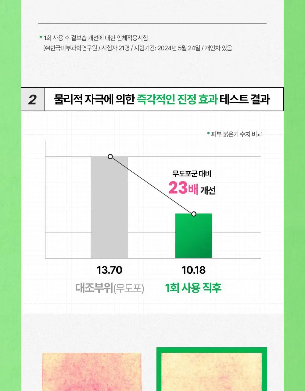 [화잘먹 엑소좀진정크림] 리브엠 시카좀 카밍 워터 젤크림 100ml 상세페이지 23